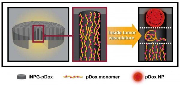 Enjekte Edilebilir Nanopartikül Üretici, Metastatik Kanser Tedavisini Kökten Değiştirebilir